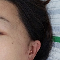 很多宝妈和准妈妈问我孩子耳朵是什么？怎么了？还有的直接说不好看、割掉之类的话，在医学上大夫叫...