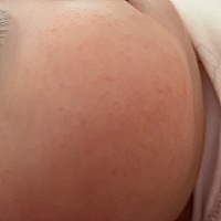 宝宝快2个月了，脸上出了好多多小痘痘。大家看看是什么？