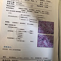 生完孩子落得一身病和不体贴的老公🙃