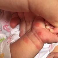 有宝妈知道这是什么吗？红又硬，有点白泡