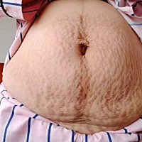 还真是那句话 怀孕需谨慎，真是伤不起啊