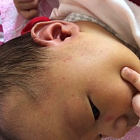 宝宝这是怎么了。今天刚起的。各位宝妈有知道的吗