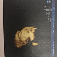 今天去做四维彩超，宝宝并不是很配合，哈哈哈，可爱不，也不知道男宝宝还是女宝宝。