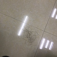 我已经决定不再测了，也不刻意去备孕了，这几天天天晚上梦见自己怀孕，都没睡好，头发掉好多吓死人了，...