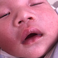 有哪位宝妈知道我宝宝脸上长了什么吗？要搽点什么药膏吗？