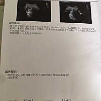 今天做的B超，还没看到胚芽！意外的是看到了两个，这样的大小算正常吗？到底是不是双胎？