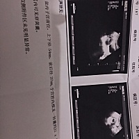 7🈷️15末次月经  想知道1号以前怀的还是以后怀的