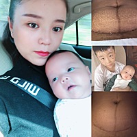 宝贝两个月了，恢复还算不错，整个月子都没做好，手关节疼，脚后跟疼……月子自己扛过来的，婆婆一共产...