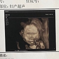肚子里的你那么丑，没想到生下来这么可爱👼