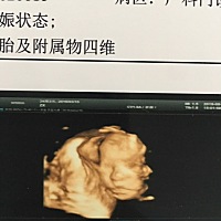各位宝妈快来帮我看看究竟是男还是女。头胎好奇😊
