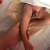 宝宝腿弯，是肌张力高吗，看了很多肌张力的症状，我感觉我宝宝全占了，有一样的腿型吗