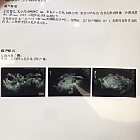 8.10末次月经，8.28照的阴超，8.30测的试纸强阳了，8.31转弱，也安排了，希望一切如愿，好孕快快来～～