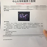 一胎女宝，备孕二胎男宝阶段，这是排卵了吗