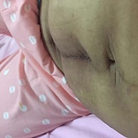 生个孩子把自己搞成这样了，婆婆还怨我没有好好照顾孩子，剖宫产，伤口疼，长湿疹，产后导汗虚弱，...
