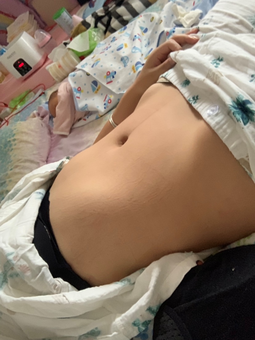 产后第8天。肚子已经全平了。可是跨和屁股还是很宽很胖。距离怀孕前体重还有30斤。好难呀，目标2个月瘦下来。加油……