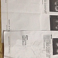 这种情况是不是很难怀孕啊