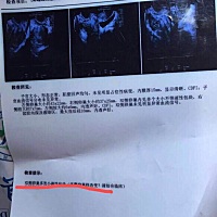 在这很感谢姐妹们的祝福，今天检查了真的怀上了，老公和婆婆激动死了，把我捧得像皇后样，说到这里怀孕...
