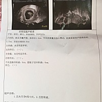 我该怎么取舍，剖腹产八个月又怀孕了🤰压抑了一个多月，本来都果断的做了决定，去看妇科准备做掉...