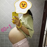 已经40 1了，偶尔有宫缩，还没有发动迹象。前两天检查出现左肾盂分离0.7CM，好像是宝宝在憋尿，真是...