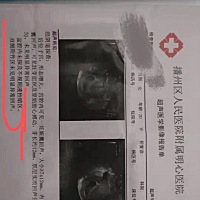 我怀孕了吗?这是真的吗?我和老公结婚五年了，一直怀不上宝宝一家人对我有意见，说话很难听，说我是不会...