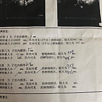 月经第16天过去了，卵泡一直没长  这个月没希望我居然不知不觉哭了，心里很难受，打针吃药各种试了还是...
