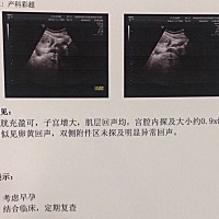 有没有亲帮我看一下我这是怀孕大概多少天了？我自己算着有40天了，可以大夫说只有30天左右。