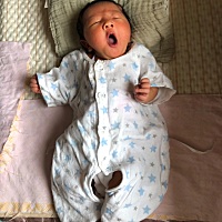宝宝出生，头上在子宫口卡出个血包，有同样经历的宝妈吗？一个月了还没消 出生 出生一个月