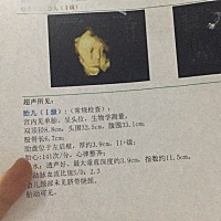 今天38➕3了。最近总是睡不好  左翻右翻都不舒服。肚子一阵阵的痛 下坠🉐️很。是要生了节奏吗？ 好期...