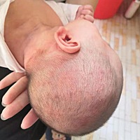 长这些需要去给医生看么？各位宝妈？？？？