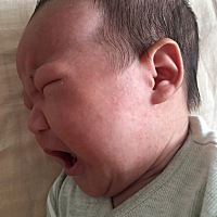 各位宝妈，请问我家宝宝脸上这是什么情况，有知道的宝妈麻烦告知一下，万分感谢！急……