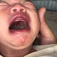 出生15天的宝宝，在哭的时候发现嘴巴上颚有几个白点点，不知道是什么？有知道的宝妈吗？正常喝奶正常拉...