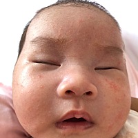 出生30多天的宝宝，哪位宝妈知道孩子脸上长是什么，怎么去除呢！