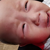 脸上长了好多疹子，医生说可能过敏，没有确定，说观察几天，过敏不是全身都长疹子的吗