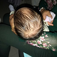 本来宝宝右边脑袋那里没睡好 有点鼓 我这十多天一直让她朝右边睡的 今天婆子妈发现右边脸大 成了大小脸 ...