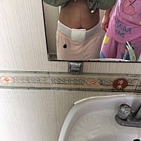 剖复产后第五天的肚子，孕期108，产前128，今天115，慢慢恢复吧。就在手术室看过宝宝一眼，直接送进了PI...