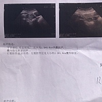 这种情况是没发育好吗？现在有大概两个月了 三次B超都不太好，医生说建议流产，心好痛呀！见不到胚芽 看...