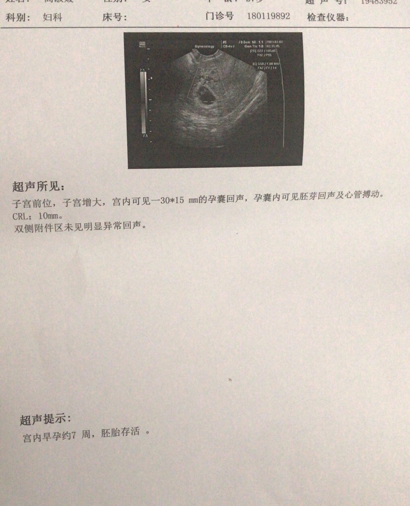 不是自己的，这是我嫂子的，她好奇这是男宝还是女宝，我帮他发了帖，各位路过的姐妹，欢迎评论。娱乐下。哈哈哈。