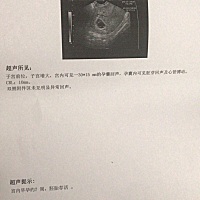 不是自己的，这是我嫂子的，她好奇这是男宝还是女宝，我帮他发了帖，各位路过的姐妹，欢迎评论。娱乐下...
