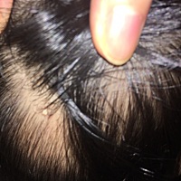 宝宝头上一个突出来的小白点，该看什么科呢