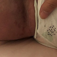 我家宝宝这颈部后面是什么，不是热疮，和湿疹，因为很长时间不消，有一点增长，但增长很慢，