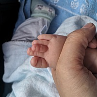 宝宝脚趾为什么会这样  会不会是穿袜子引起的 哥哥月子里面也穿了袜子呀 也不像这样  妹妹脚比哥哥的胖