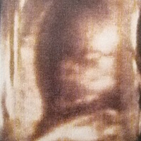 希望十一前宝宝们能够回到我的身边，妈妈想你们了呢