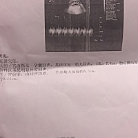 娱乐一下，有宝妈会看的吗？男孩还是女孩哪个几率大点？