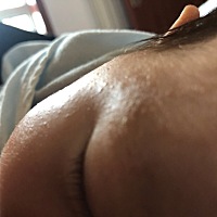 请问各位宝妈，孩子脸上起的这个是湿疹么