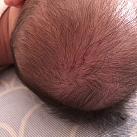 求问各位宝妈，宝宝三个月多，得了湿疹，昨天去医院看了，医生让买雅漾，开了药膏一起用。但是回来后，...
