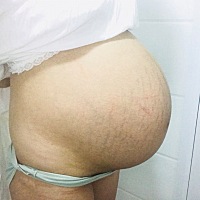 有要求看肚型猜男女 我就提供图片给大家对比 男娃的！