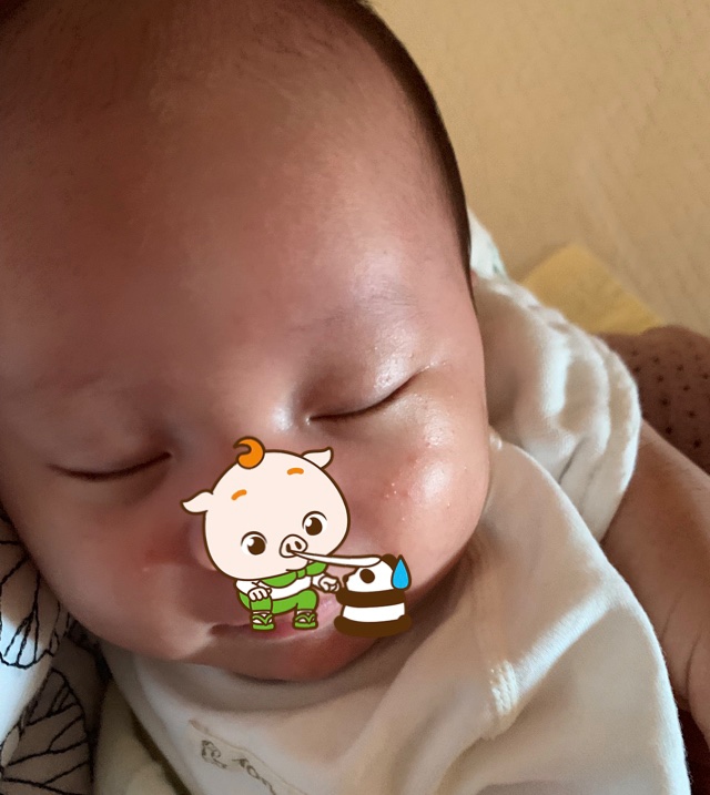 宝妈们，有谁知道宝宝脸上长的这个是什么？是痱子吗？有经验的宝妈留下治疗方法给我好吗？谢谢了🙏