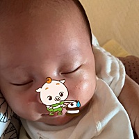 宝妈们，有谁知道宝宝脸上长的这个是什么？是痱子吗？有经验的宝妈留下治疗方法给我好吗？谢谢了🙏