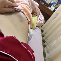 有没有人知道这是什么？坐月子期间长了这个，腿上也有