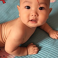 是妈妈没照顾好你。卡床边了。特别心疼。特别内疚。以后妈妈一定更加小心的呵护你。希望宝贝不要留疤。